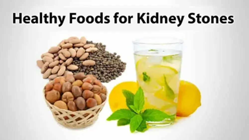 Does Green Tea Cause Kidney Stones? 
